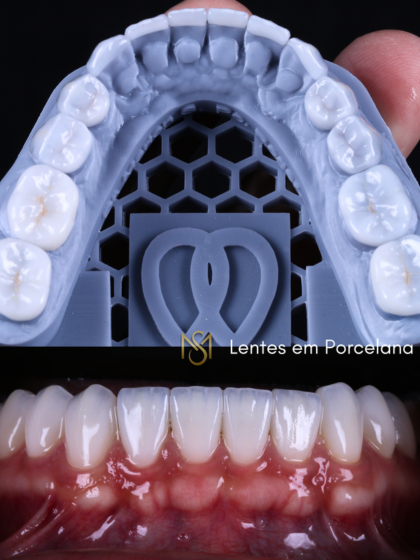 Paciente com dor lombar